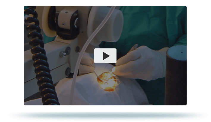 Patient Educational Videos of Sydwest Eye Specialists